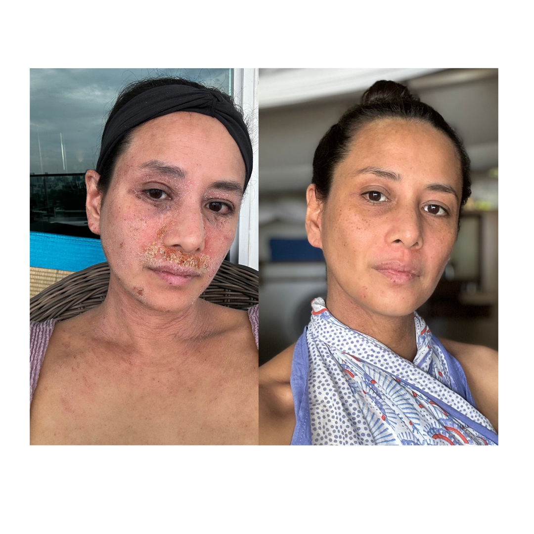 TSW , skin intelligence 2023